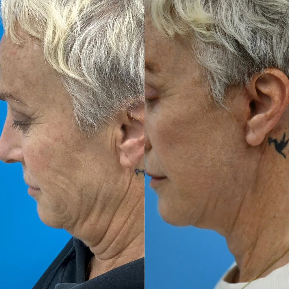 Case 07 — before and after