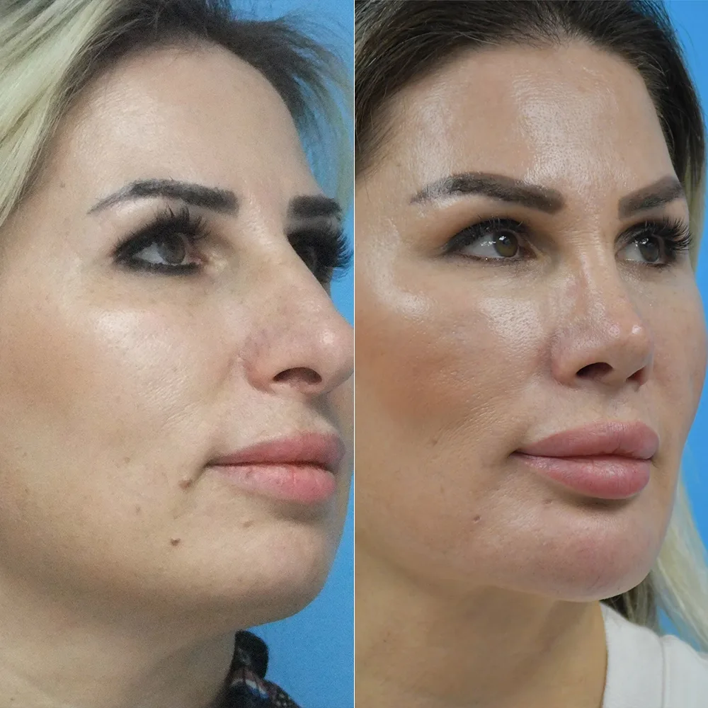 Case 05 — before and after