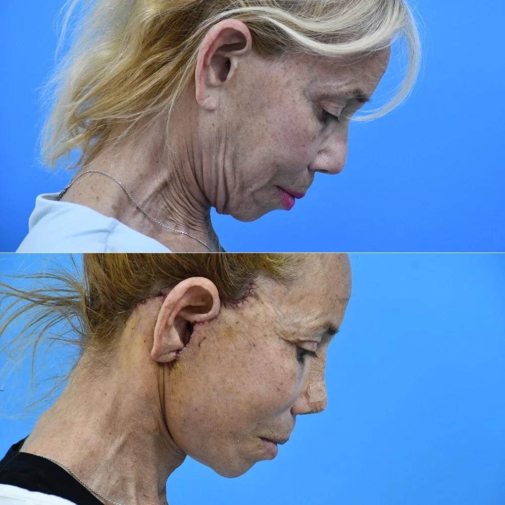 Case 12 — before and after