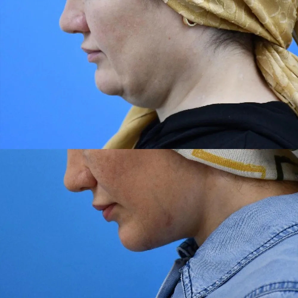 Case 06 — before and after
