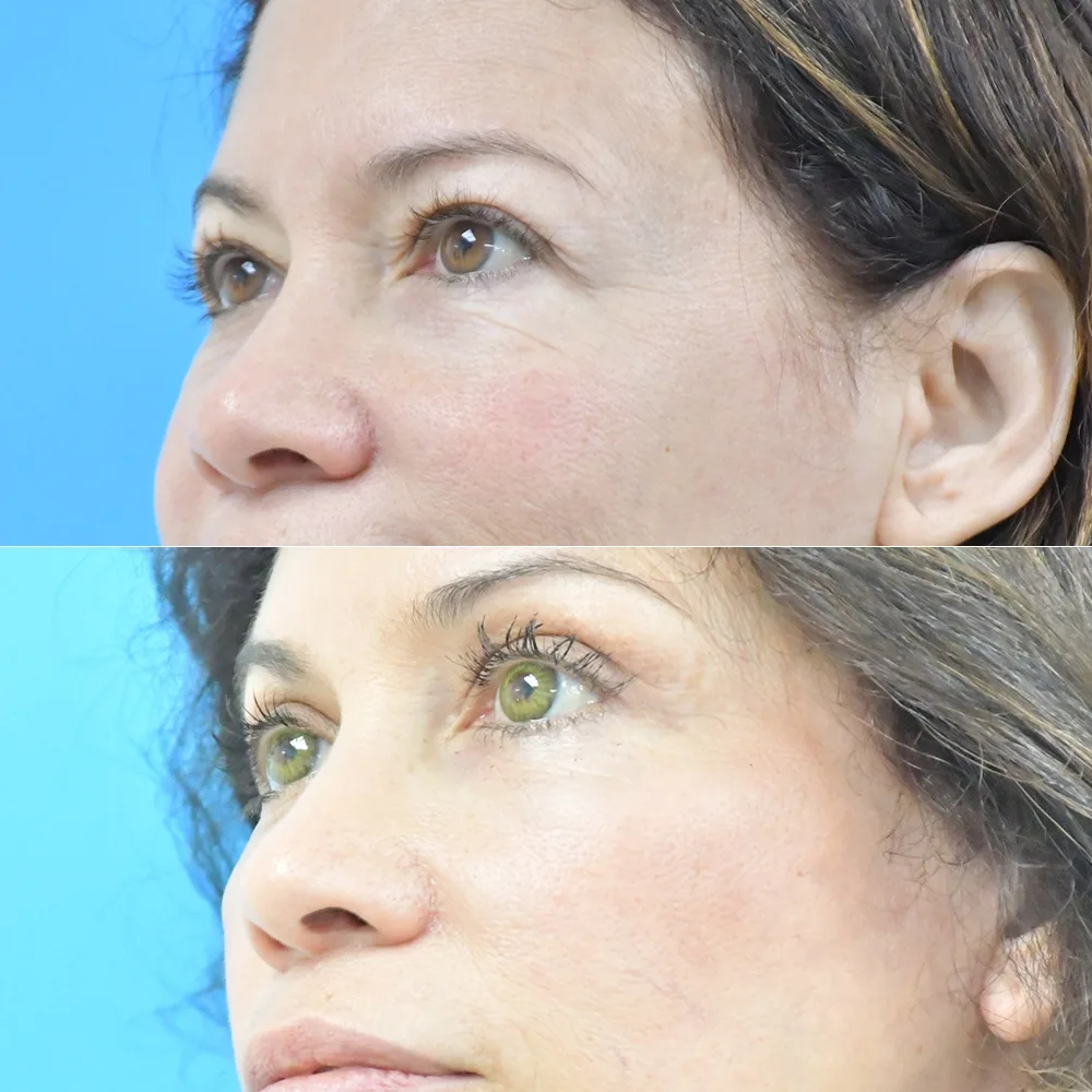 Case 01 — before and after