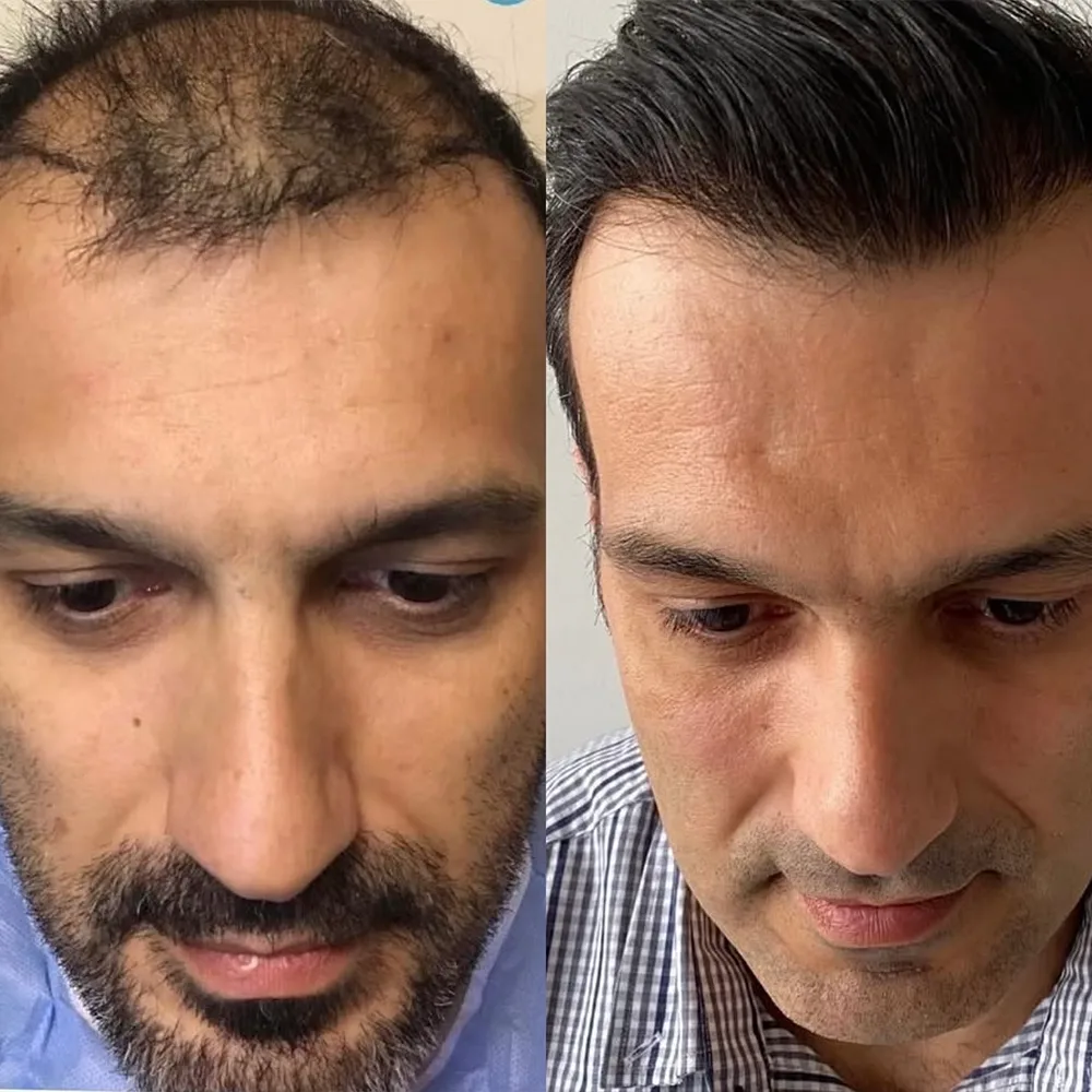 Case 08 — before and after