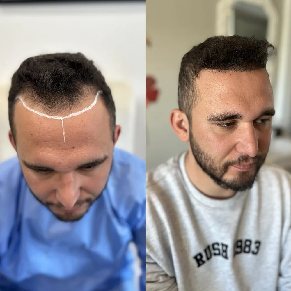 Case 03 — before and after