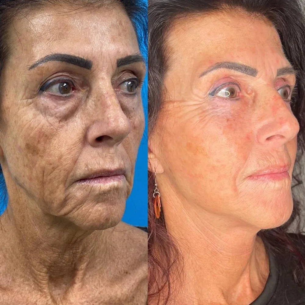 Case 05 — before and after