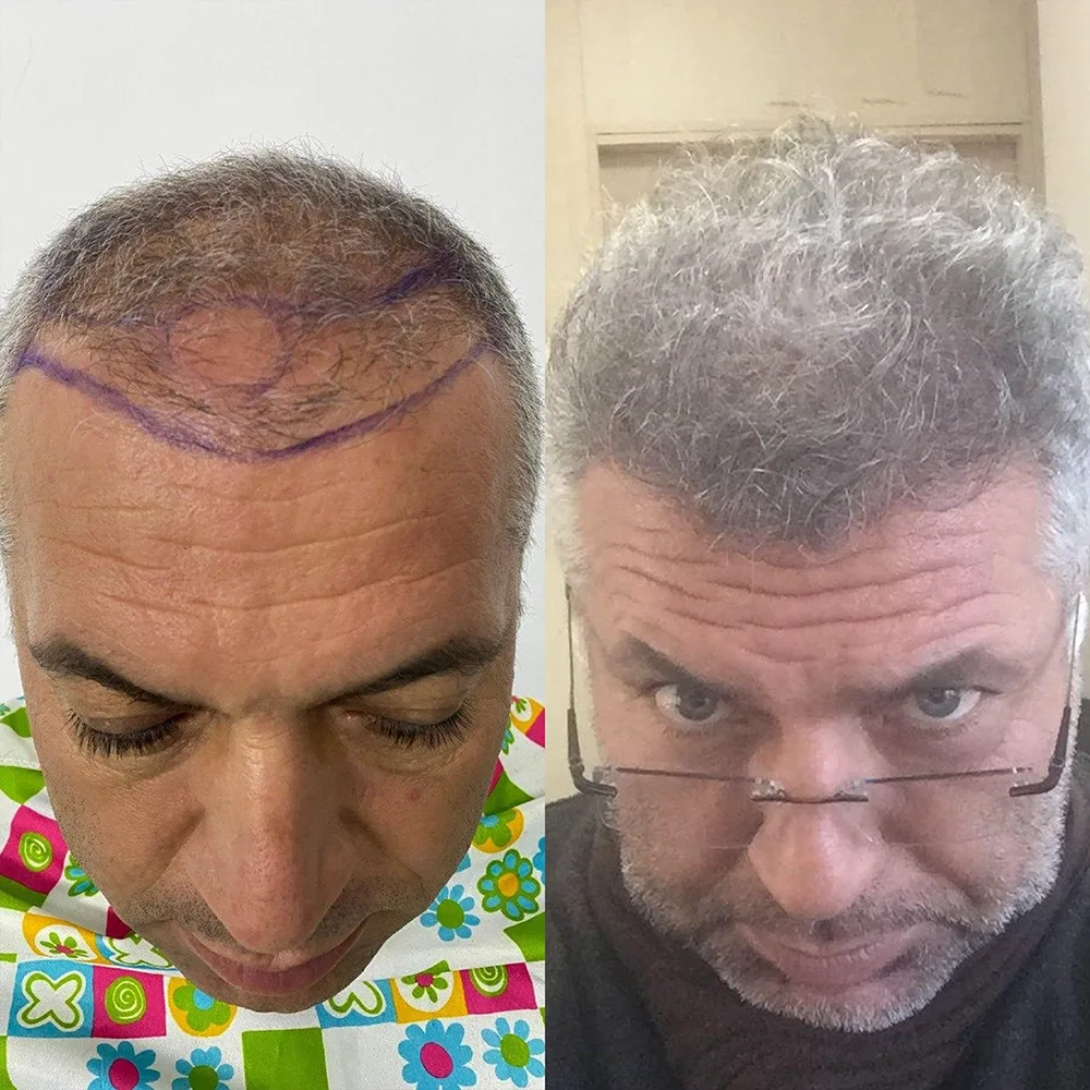 Case 07 — before and after