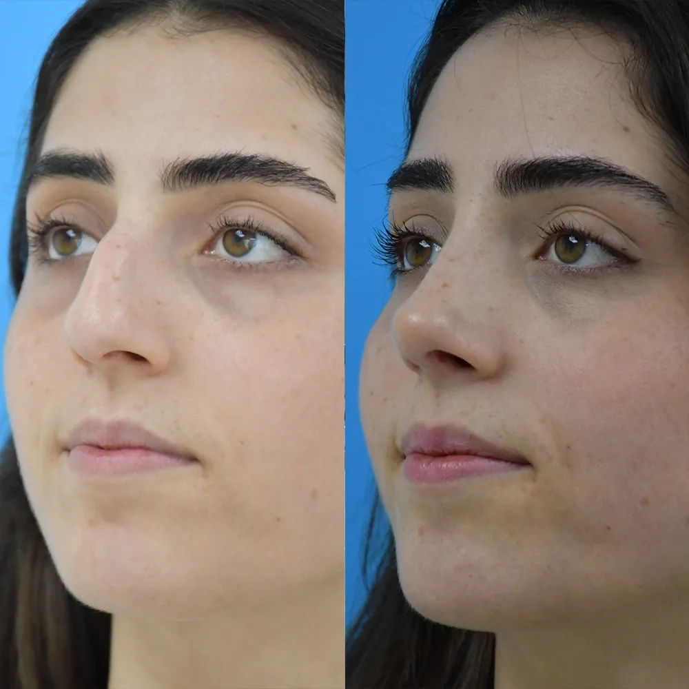 Case 02 — before and after
